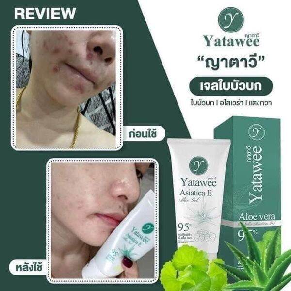 จัดส่งไว-ขายแต่ของแท้-เจลใบบัวบก-ญาตาวี-yatawee-ขนาด-50ml