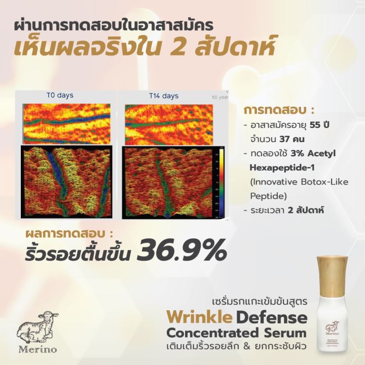 เซรั่มรกแกะเข้มข้น-แพ็คคู่-2-ขวด-สูตร-wrinkle-defense-concentrated-serum-เติมเต็มริ้วรอยลึก-เพิ่มความชุ่มชื้น-ด้วยรกแกะแท้-อนุภาคนาโน