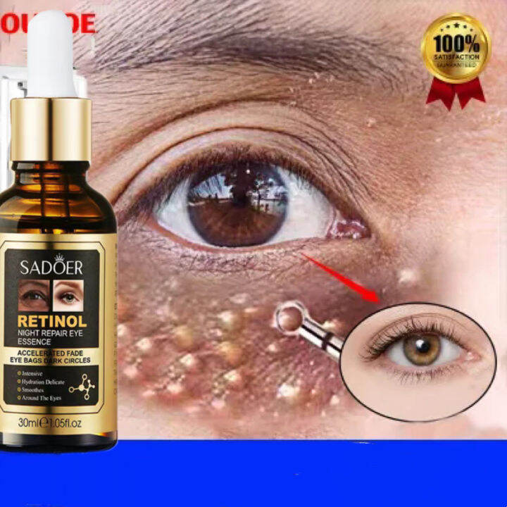 sadoer-retinol-eye-serum-for-eye-bags-dark-circle-remover-anti