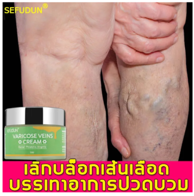 【ผู้ขายในท้องถิ่น】SEFUDUN ยาทาเส้นขอด เส้นเลือดขอด 50g ครีมหลอดเลือดดำบอกลาเส้นเลือดขอด ครีมทาเส้นเลือดขอด แมงมุมเส้นเลือดปวด ครีมเส้นเลือดขอด ยาทาเส้นเลือดขอด Varicose Vein Cream