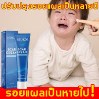 【ฟื้นฟูผิวให้แข็งแรง】EELHOE ครีมกำจัดรอยแผลเป็น แผลเป็น แผลเป็นจากการผ่าตัด ครีมทารอยแผลเป็น ซ่อมแซมผิวที่เสียหาย（ครีมทาแผลนูน ครีมทาแผลเป็น ครีมแผลเป็น ยาทาแผลเป็นนูน ครีมลบรอยแผล ครีมลบรอยแผลเป็น ครีมรอยแผลเป็น ครีมลดแผลเป็น）