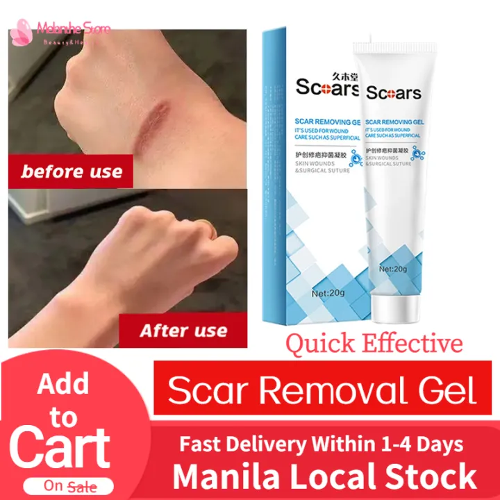 【13 days delivery】Melanthe old scar remover for body and face scar gel