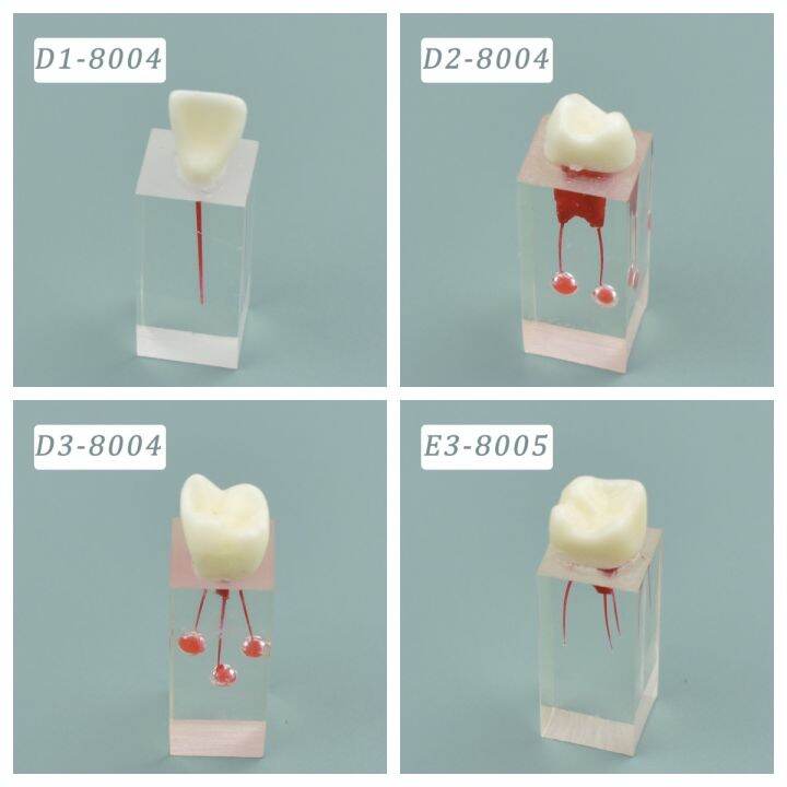 Dental Endo Training Block Tooth Endodontics Root Canal Model Dentistry