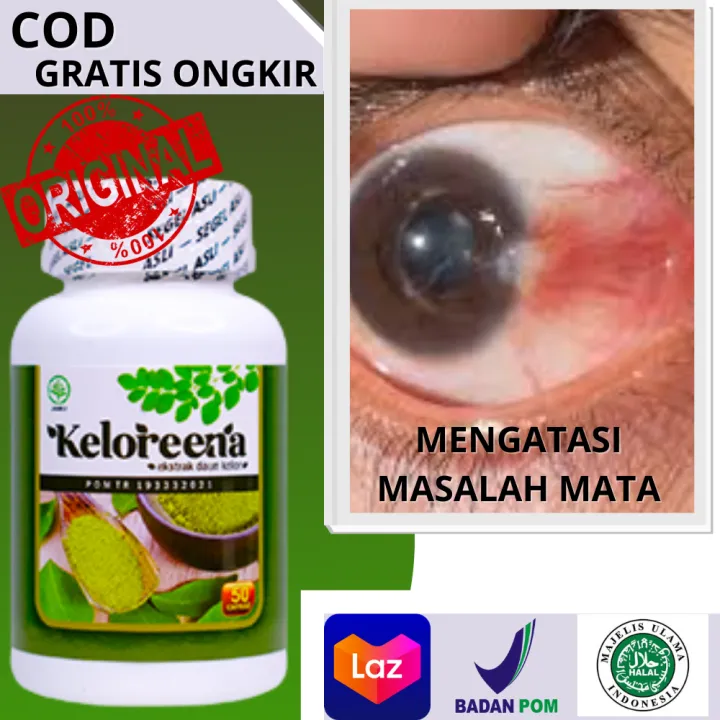 Obat Pterigium, Herbal Untuk Menghilangkan Mata Berselaput Putih, Suplemen  Buat Mengobati Mata Merah, Vitamin Mengatasi Mata