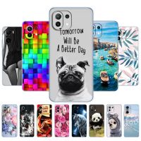 ♙✶∋ For xiaomi Mi 11 / Mi 11 Lite 5G NE 4G / Mi 11i / Mi 11 Ultra Case Back Phone Cover For Xiomi Mi11Lite Protective Coque Bumper