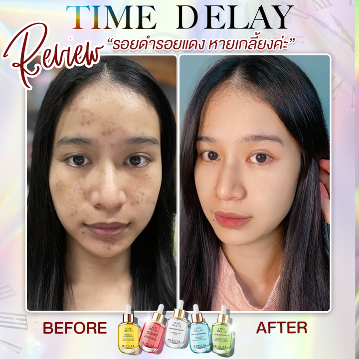 สูตรใหม่-พร้อมส่ง-เพิ่มโสม-คอลลาเจน-ทองคำ-สูตรสลายฝ้าหนัก-time-delay-serum-ไทม์ดีเลย์-เซรั่มย้อนวัย-เซรั่มเมย์-พิชญ์นาฏ-เซรั่มสูตรแพทย์