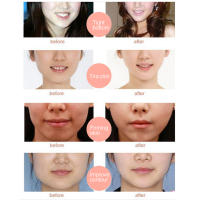 3 ชิ้น 4D V Shaped Facial Mask V Line Lifting Mask Chin Up กระชับผิวกระชับ