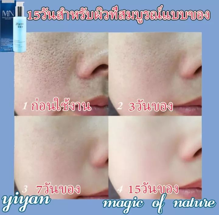 รูขุมขนหดตัวสาระสำคัญ-120ml-ทำให้ผิวขาวขึ้น-เติมเต็มความชุ่มชื้นให้ผิว-เซรั่มหน้าใส-เซรั่มบำรุงผิว-รูขุมขนหดตัว-รูขุมขนกระชับขึ้น-ไวท์เทนนิ่ง-เซรั่มกระชับใบหน้า-กรดไฮยาลูโรนิก-เซรั่มบำรุงผิวหน้า-เซรั่