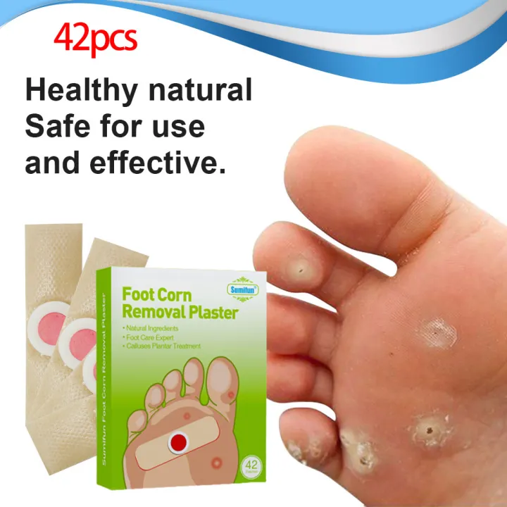 【100% Authentic】Local delivery 42Pcs Sumifun Feet Corns/ Warts Removal ...