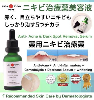 ครีมหมอญี่ปุ่น Hada Tokyo  ครีมรักษา  สิว สิวอักเสบ สิวผด สิวหนอง รักษาได้ หน้าใส ไร้สิว ผิว  ขาวเนียน Anti-Acne Dark Spot Removal Gel