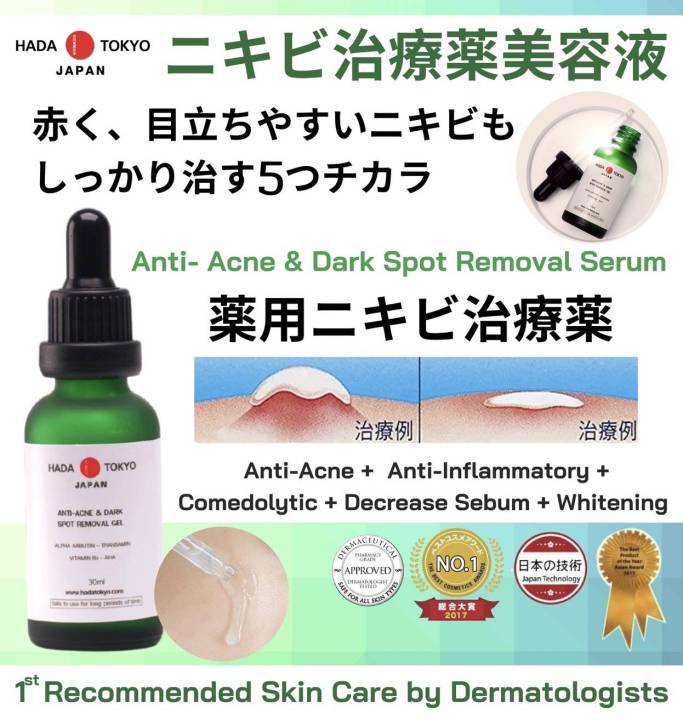 ครีมหมอญี่ปุ่น-hada-tokyo-ครีมรักษา-สิว-สิวอักเสบ-สิวผด-สิวหนอง-รักษาได้-หน้าใส-ไร้สิว-ผิว-ขาวเนียน-anti-acne-dark-spot-removal-gel