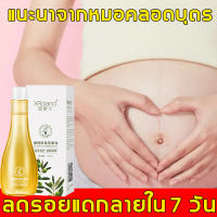 【ผู้ขายในท้องถิ่น】ครีมลดรอยแตกลาย อ่อนโยนต่อผิว ปราศจากสีสังเคราะห์หรือแอลกอฮอล์ สามารถป้องกันรอยแตกลาย（ครีมขาแตกลาย ลดแตกลาย ครีมลดรอยขาลาย ครีมท้องแตกลาย ครีมทาแตกลาย ครีมทาลายแตก ท้องลาย ลดขาลาย）Stretch Mark Cream