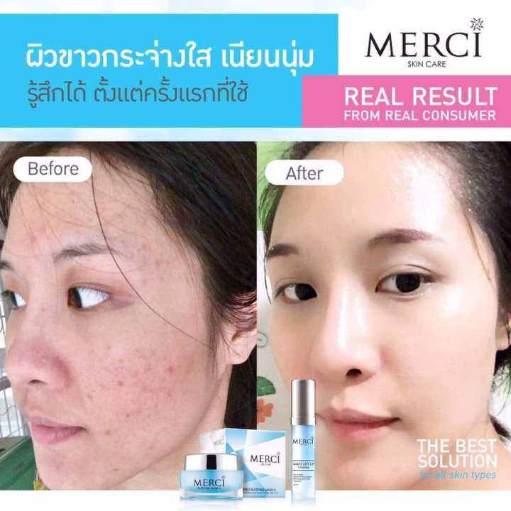 สินค้าแท้-100-ลดสิว-ลดผื่นได้ดี-merci-sleeping-maskii-30g-เมอร์ซี่-สลิปปิ้ง-มาส์ค-ทู-ครีมมาส์คหน้าขาวกระจ่างใส-ช่วยลดสิวผดผื่นบนใบหน้า