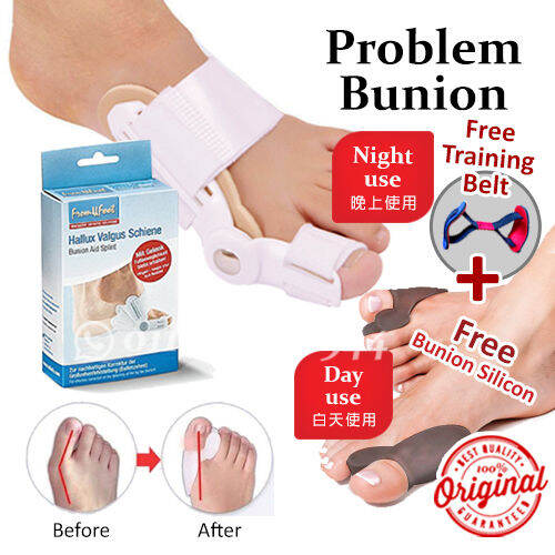 Bunion Aid Splint Hallux Valgus Schiene 拇指外翻 bunion accessories Lazada