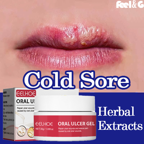 Canker sore gel 50ml 3 seconds pain relief mouth ulcer gel Canker mouth