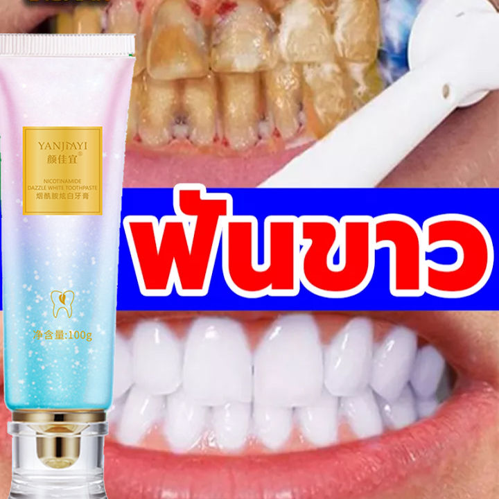 ยาสีฟัน-ยาสีฟันไวท์เทนนิ่ง-ฟอกฟันขา-ลดกลิ่นปาก-ลมหายใจ-หอมสดชื่น-100g