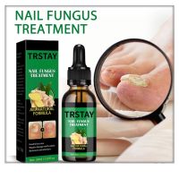 Fungicidal Nail Essential Oils Fungus Feet Care Serum Toe Nails Gel Anti Infection