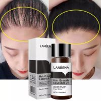 ?แลนบีน่า?Hair Growth Essence Fast Powerful Hair Grower Hair Care 100% Pure Natural Treatment Hair Loss Treatment Hair Care Essence Oil Liquid Extract Treatment ป้องกันผมร่วง20ML