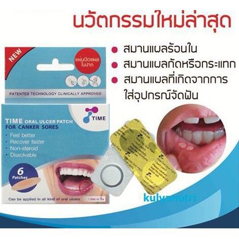 แผ่นแปะร้อนใน-time-oral-ulcer-patch-1-5-cm-แผลร้อนใน-แผลในปาก-แผลจัดฟัน