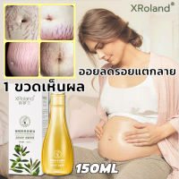 XRoland ครีมลดรอยแตก 150g ขาแตกลาย ลดรอยแตกลาย เพิ่มความชุ่มชื้นให้แก่ผิว กระชับผิวให้เรียบเนียน (ครีมทาแตกลาย,ครีมทารอยแตกขา,ครีมกันแตกลาย,ครีมทาท้องลาย,ครีมทารอยแตก,ครีมรอยเเตกลาย,ครีมทาหลังคลอด,ครีมแก้แตกลาย,ครีมแก้ท้องลาย ลดผิวแตกลาย,ครีมท้องลาย)