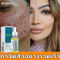 HEMEIEL เชรั่มหน้าใส/ครีมทาสิว/เจลลดสิว