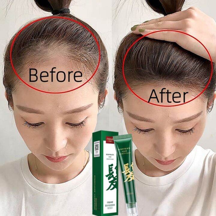 new hair loss treatment hair growth tonic anti hair loss hair growth