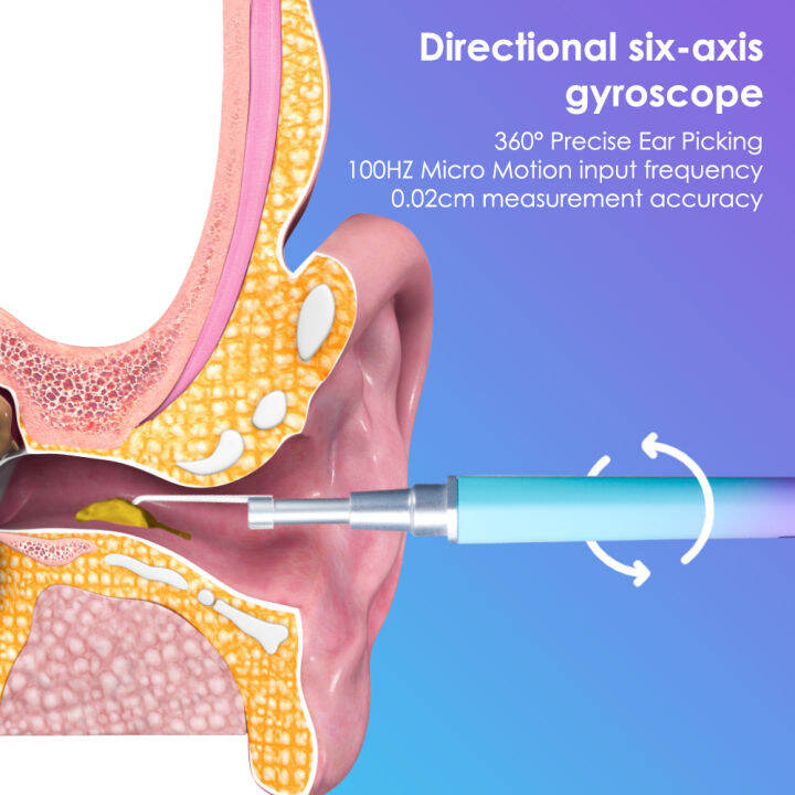 การดูแลสุขภาพหูขี้ผึ้งทำความสะอาดไร้สาย-otoscope-ขี้หู-remover-กล้อง-hd-endoscope-ภาพส่องสว่าง-earpick-สำหรับ-ios-ระบบ