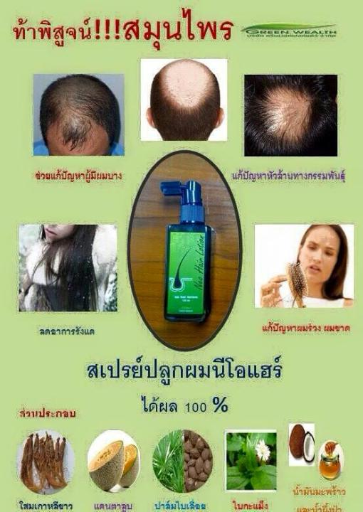 neo-hair-lotion-นีโอแฮร์โลชั่น-ผลิตภัณฑ์บำรุงรากผม-หนังศีรษะ-และดูแลเส้นผม-ล็อตใหม่ล่าสุด