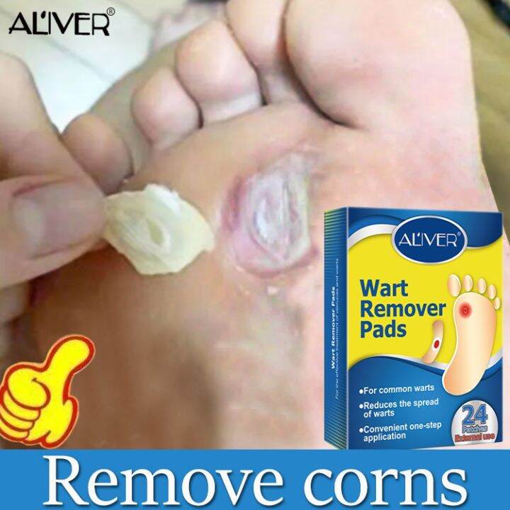 ALIVER corns remover 24 Pcs,painless removal plantar warts,foot corn