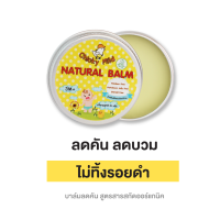 บาล์มทายุงกัด ครีมทายุงกัด บาล์มลดคัน Chicky Mild ช่วยลดคัน ลดบวมแดง ไม่ทิ้งรอยดำ ป้องกันขาลาย ใช้ได้ตั้งแต่เด็ก 3 เดือนขึ้นไป ปาล์มสูตรสารสกัดธรรมชาติ อ่อนโยน ขนาด 15 กรัม