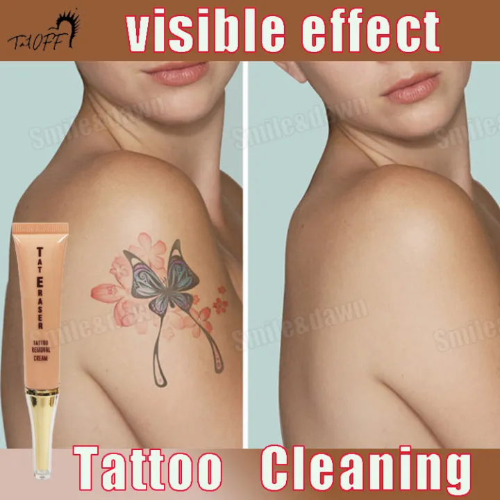 Tattoo Removal Creams: A Guide For Beginners LaserAll | Tattoo Removal Cream  Permanent Removal Of Tattoos Tattoo Removal Cream 