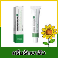 【แพทย์แนะนำ】ผู้เชี่ยวชาญด้านสิว? ครีมลดสิว ครีมรักษาสิว ครีมจางรอยสิว รอยสิวจางลง รักษาสิวอย่างอ่อนโยน ไม่ระคายเคือง แก้ปัญหาสิวทุกชนิด ปฏิเสธการเกิดสิวกำเริบ เซรั่มกำจัดสิว ครีมรักษาสิว ครีมแต้มสิว ครีมลดรอยสิว ลดรอยดำจากสิว ครีมกำจัดสิว ครีมกำจัดรอยสิว