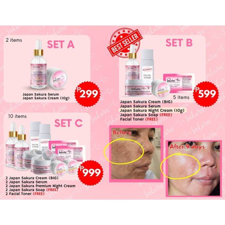 Japan Sakura Melasma Remover Cream Serum Soap Toner Sunblock for all ...