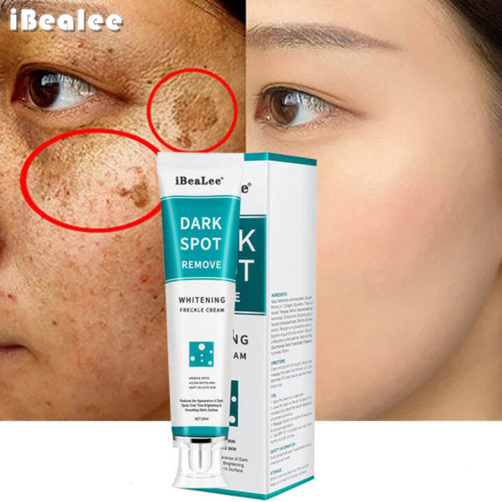 zwm-hot-stings-whitening-freckles-cream-remove-melasma-dark-spots-lighten-เมลานิน-melasma-remover-moisturizing-brighten-face-skin-care