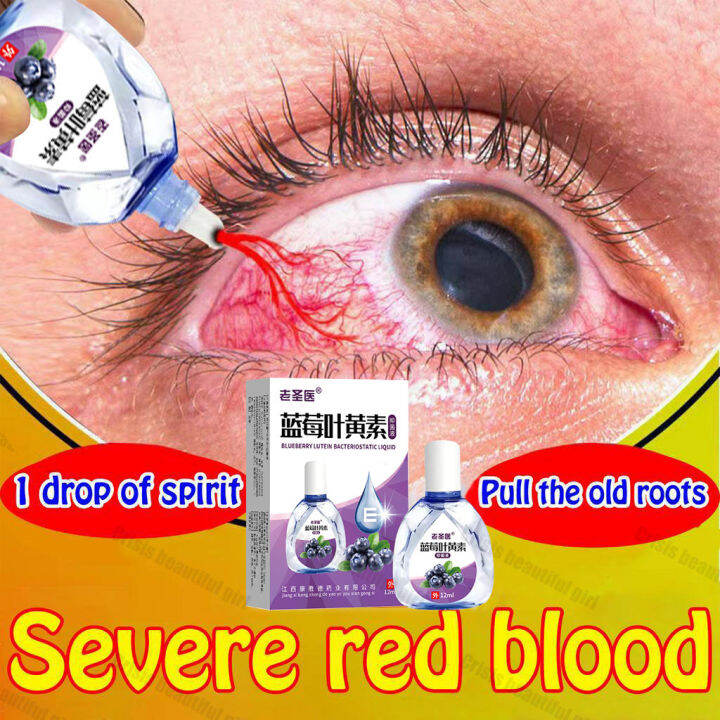Blueberry Lutein Eye Drops 12ml treatment cataract dry eye eyestrain