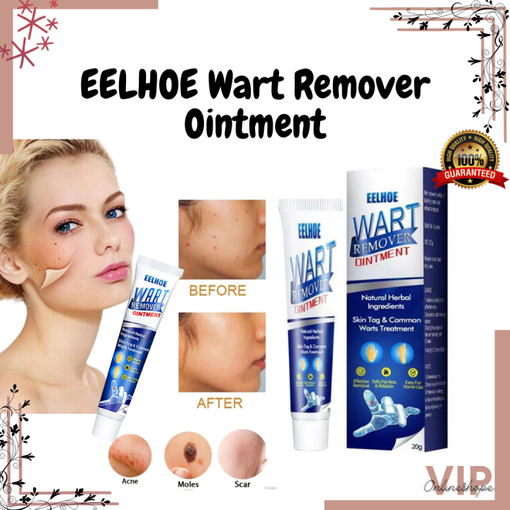 Original Eelhoe Warts Remover Cream Antibacterial Ointment Wart ...