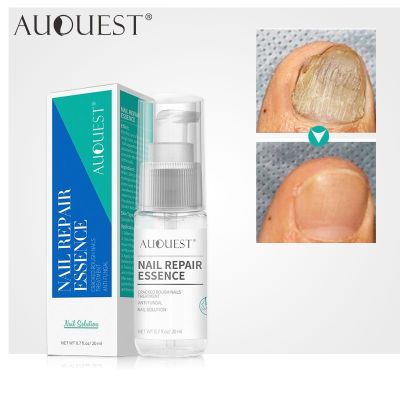 AUQUEST Fungal Nail Treatment Serum Feet Care Essence Anti Infection Paronychia Onychomycosis Nail Fungus Removal Gel 20ml