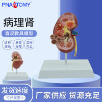 โรคโครงสร้างไตของมนุษย์ทางกายวิภาคของอวัยวะภายในระบบทางเดินปัสสาวะ Nephrology Nephrology