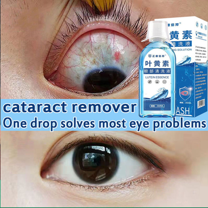 Medical Eye Wash Solution Care Liquid Suitable For Bloodshot Dry Itchy ...