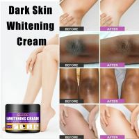 New Women Dark Skin Whitening Cream Bleaching Cream Face Body Whiten Underarm Private Parts Armpit Arms Legs Neck Elbows Knees