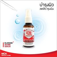 *ส่งฟรี!!ไม่มีขั้นต่ำ* McKrime ACNE SERUM เซรั่มดูแลผิวหน้าสำหรับผิวที่เป็นสิวเรื้อรังและผิวหมองคล้ำ แพ้ง่าย แมคไครม์ แอคเน่ เซรั่ม 30 ml.