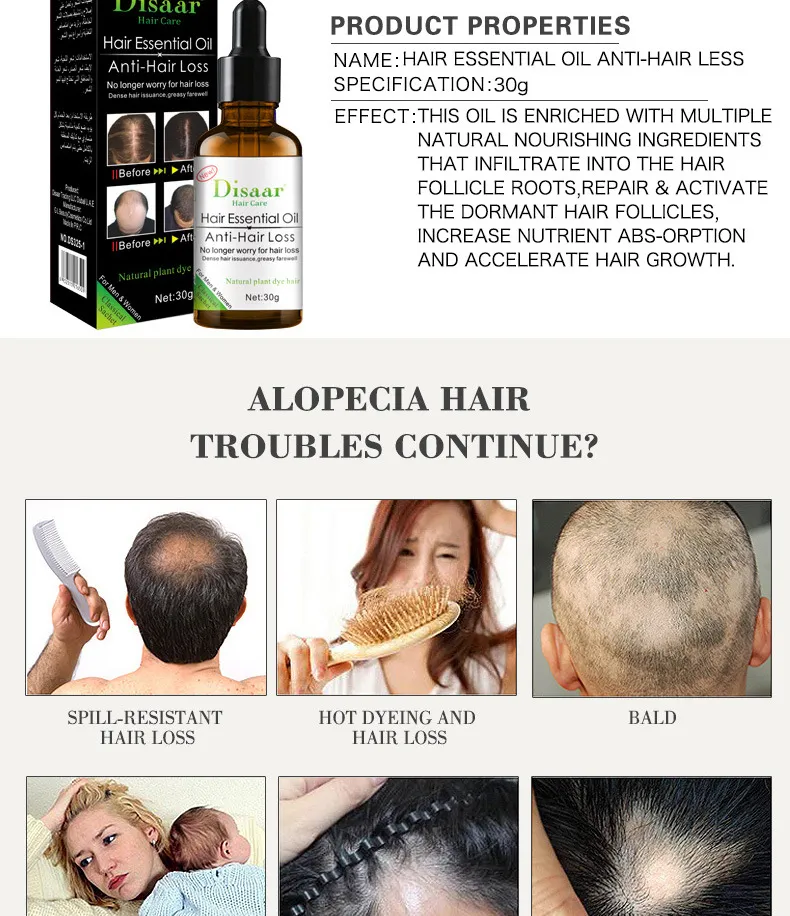 Herbal Hair Growth Cream China Trade,Buy China Direct From Herbal Hair  Growth Cream Factories At | Regenerating Organic Anti-hair Loss Cream |  