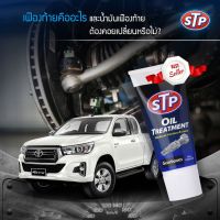 STP Oil Treatment Gearbox หัวเชื้อน้ำมันเกียร์ธรรมดา และ เฟืองท้าย 150 ML