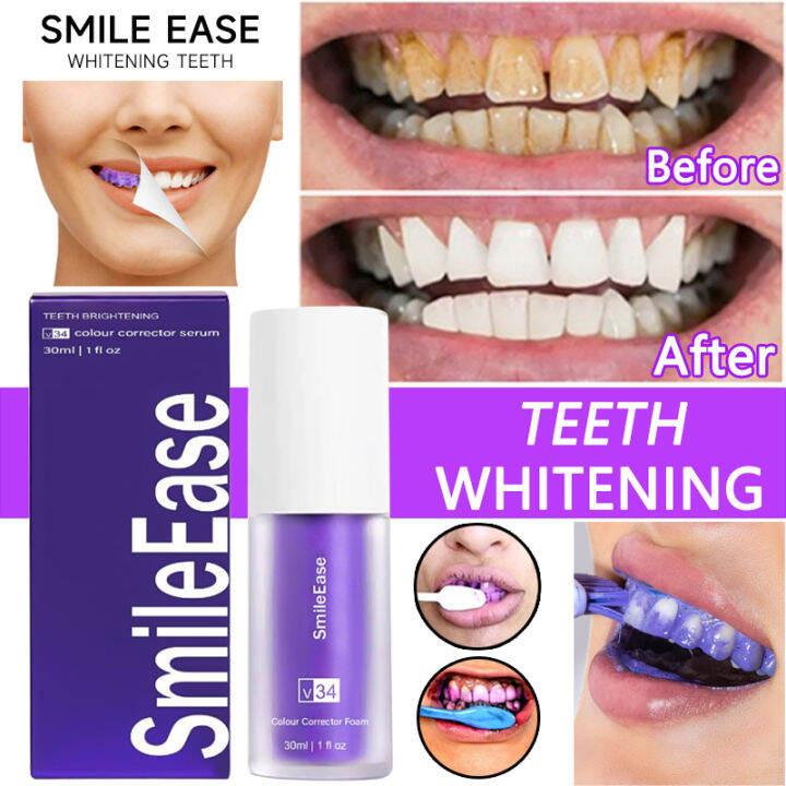 Smile Ease Toothpaste V34 toothpaste violet toothpaste Teeth whitening ...