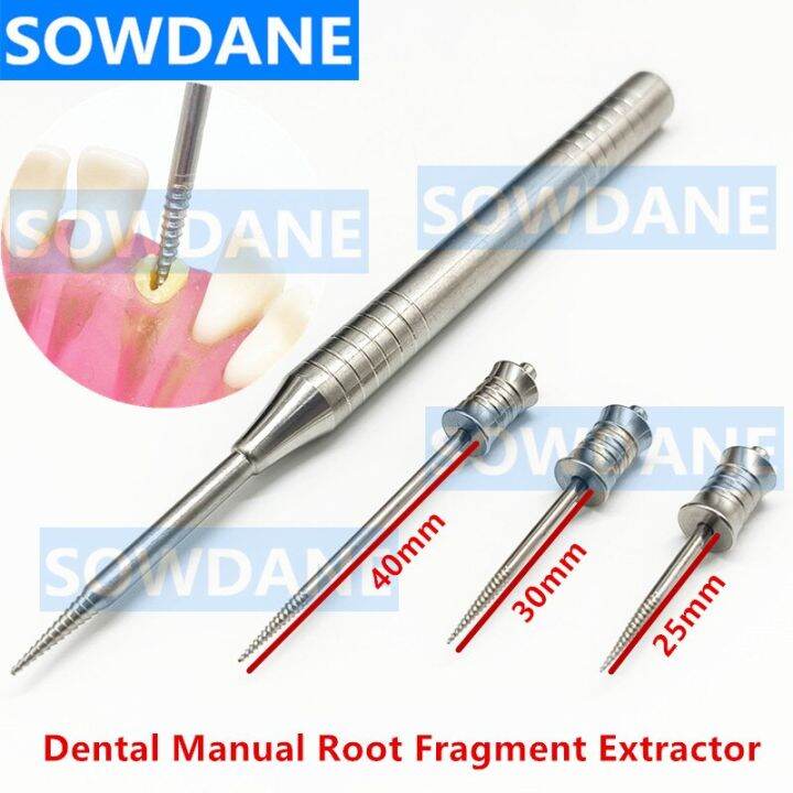 Dental Root Tooth Extraction Screw Dental Root Screw Extractor Apical