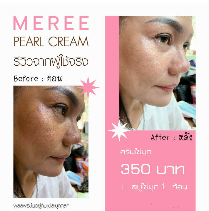 meree-pearl-cream-12g-3cart-ครีมไข่มุกเมรี-12กรัม-3ตลับ-meree-soap-60g-3pcs-สบู่ไข่มุก-3ก้อน-60กรัม