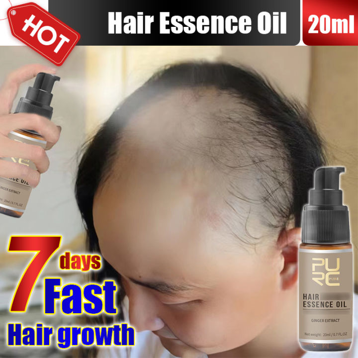 💙WT💙 hair growth spray hair grower for men original hair growth serum ...