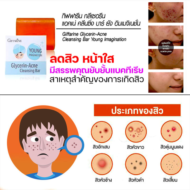 สบู่ล้างหน้า-วัยรุ่น-แอคเน่-คลีนซิ่ง-บาร์-กิฟฟารีน-สบู่กลีเซอรีน-ผิวหน้าชุ่มชื้น-ไม่แห้งตึง