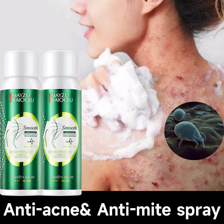 Acne Spray Acne Remover For Arms Back And Body Back Acne Treatment Oil