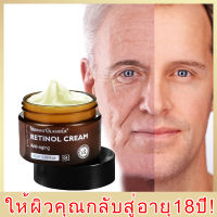 ครีมเรตินอล ครีมลดเลือนริ้วรอย ครีมหน้าขาว retinol cream ลดรอยตีนกา ร่องแก้ม ริ้วรอยหน้าผาก ขจัดความหมองคล้ำ ยกกระชับ ครีมบำร